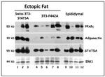 Adiponectin Antibody in Western Blot (WB)