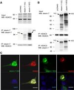 Ataxin 7 Antibody in Western Blot, Immunoprecipitation (WB, IP)