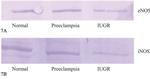 eNOS Antibody in Western Blot (WB)