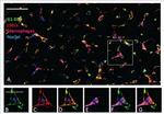 CD68 Antibody in Immunohistochemistry (IHC)