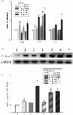 Sir2.1 Antibody in Western Blot (WB)