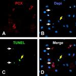 PODXL Antibody in Immunocytochemistry (ICC/IF)