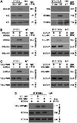 Vinculin Antibody in Western Blot, Immunoprecipitation (WB, IP)