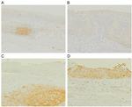 MSH2 Antibody in Immunohistochemistry (IHC)