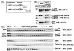 beta Amyloid Antibody in Western Blot (WB)