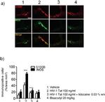 S100B Antibody in Immunohistochemistry (IHC)