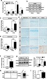 CHI3L1 Antibody in Western Blot, Immunohistochemistry (WB, IHC)