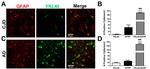 CHI3L1 Antibody in Immunohistochemistry (IHC)