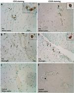 CD20 Antibody in Immunohistochemistry (IHC)