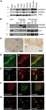 Mitofilin Antibody in Western Blot (WB)