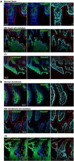 Intestinal Alkaline Phosphatase Antibody in Immunohistochemistry (IHC)