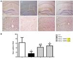 CD31 Antibody in Immunohistochemistry (IHC)