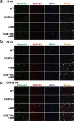 SQSTM1 Antibody in Immunohistochemistry (IHC)