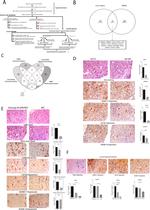 ADAM17 Antibody in Immunohistochemistry (Paraffin) (IHC (P))