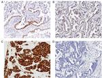 Estrogen Receptor alpha Antibody in Immunohistochemistry (IHC)