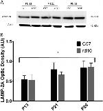 LAMP-2A Antibody in Western Blot (WB)