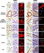 Estrogen Receptor beta Antibody in Immunohistochemistry (IHC)