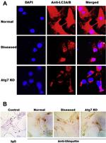 LC3A/LC3B Antibody in Immunocytochemistry (ICC/IF)