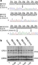 CTC1 Antibody in Western Blot (WB)