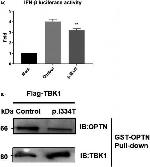 TBK1 Antibody in Western Blot (WB)
