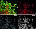 CD31 Antibody in Immunohistochemistry (IHC)