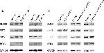 CRY1 Antibody in Western Blot (WB)