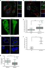 Rab4 Antibody in Immunocytochemistry (ICC/IF)