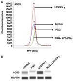 ADSS Antibody in Western Blot (WB)