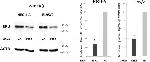 Estrogen Receptor Beta Antibody in Western Blot (WB)