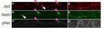 Phospho-RET (Tyr905) Antibody in Immunohistochemistry (IHC)