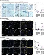 Phospho-AKT1 (Ser473) Antibody in Immunohistochemistry (IHC)