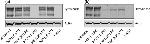 Tyrosinase Antibody in Western Blot (WB)