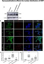 Tau Antibody in Immunocytochemistry (ICC/IF)