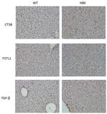 Cathepsin B Antibody in Immunohistochemistry (IHC)