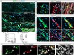 SCF Antibody in Immunohistochemistry (IHC)