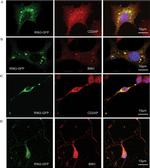 BIN1 Antibody in Immunocytochemistry (ICC/IF)