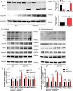 CD2AP Antibody in Western Blot (WB)