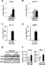 NCEH1 Antibody in Western Blot (WB)