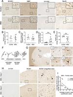 MBP Antibody in Immunohistochemistry (IHC)