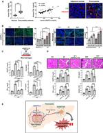 ANGPTL4 Antibody in Neutralization (Neu)