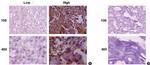 LAPTM4B Antibody in Immunohistochemistry (IHC)