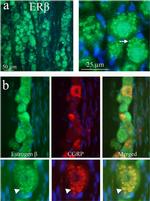 Estrogen Receptor beta Antibody in Immunohistochemistry (IHC)