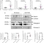 Asporin Antibody in Western Blot (WB)