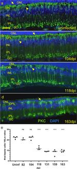 PKC alpha Antibody in Immunohistochemistry (IHC)