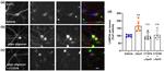 LAMP-2A Antibody in Immunocytochemistry (ICC/IF)