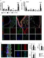 MMP12 Antibody in Immunohistochemistry (IHC)