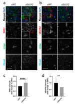 VE-cadherin Antibody in Immunocytochemistry (ICC/IF)