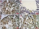 ID4 Antibody in Immunohistochemistry (IHC)