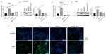 TGF beta-1 Antibody in Immunocytochemistry (ICC/IF)