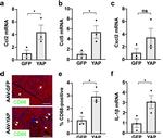 Cardiac Troponin T Antibody in Immunohistochemistry (Paraffin) (IHC (P))